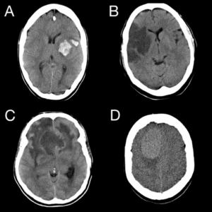 image of a head CT scan